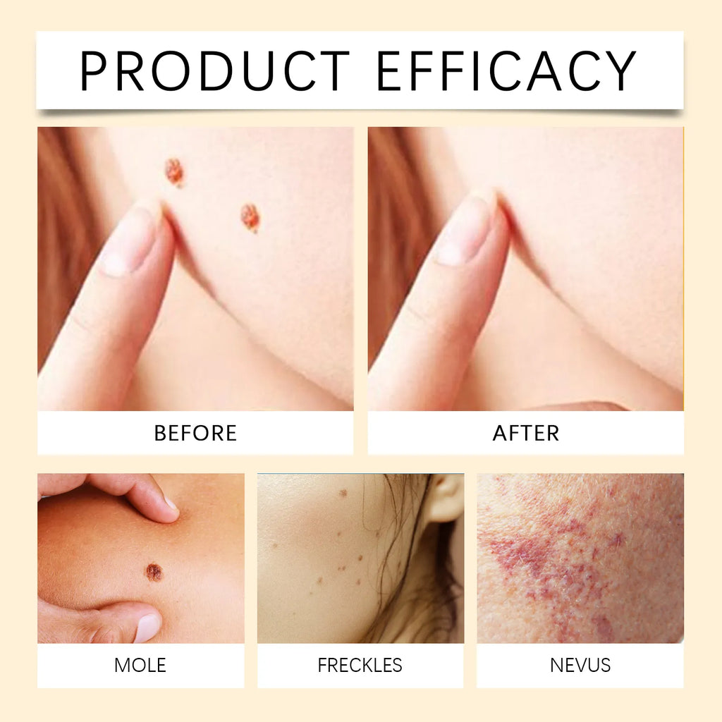 HOUKEA Advanced Bee Venom Skin Serum - Moisturizing & Restorative Treatment